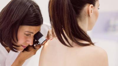 Melanoma: Un cáncer agresivo que puede ser frenado con un diagnóstico temprano Melanoma: Un cáncer agresivo que puede ser frenado con un diagnóstico temprano
