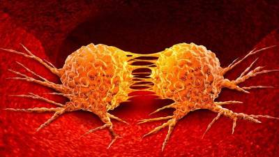 Descubren cómo un ácido graso de aceite de palma aumenta el riesgo de metástasis en pacientes con cáncer Descubren cómo un ácido graso de aceite de palma aumenta el riesgo de metástasis en pacientes con cáncer