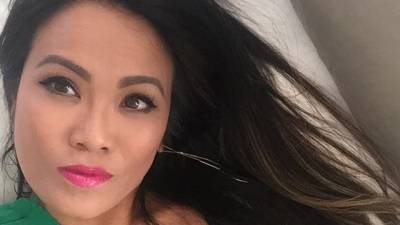 La mujer que se hizo famosa por reventar barros y espinillas La mujer que se hizo famosa por reventar barros y espinillas