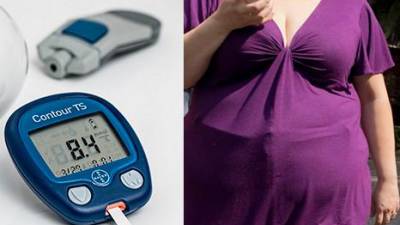 Diabesidad: Todo lo que necesita saber sobre esta creciente condici&oacute;n m&eacute;dica