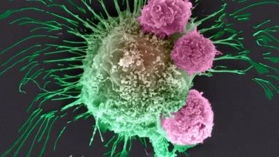 El impacto que tuvo la pandemia en los pacientes con cáncer El impacto que tuvo la pandemia en los pacientes con cáncer