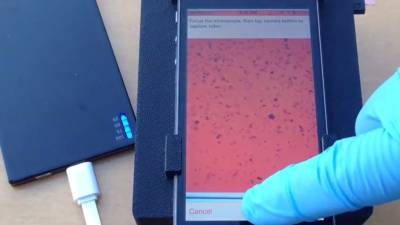 Un microscopio para smartphones puede detectar parásitos en una gota de sangre Un microscopio para smartphones puede detectar parásitos en una gota de sangre