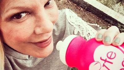 Tori Spelling luce desfigurada tras tratamiento de belleza Tori Spelling luce desfigurada tras tratamiento de belleza