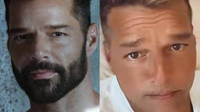 Ricky Martin responde a las cr&iacute;ticas por el inusual cambio en su rostro
