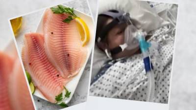 Mujer comi&oacute; tilapia poco cocida, luego enferm&oacute; y le amputaron las extremidades en Estados Unidos 