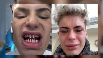Joven se hizo un dise&ntilde;o de sonrisa y el resultado fue devastador: &ldquo;Era como algo salido de una pel&iacute;cula de terror&rdquo;