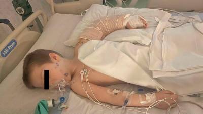Padre salva la vida de su hijo tras ser brutalmente atacado por un perro con una t&eacute;cnica que vio en la serie &quot;Grey&acute;s Anathomy&quot;