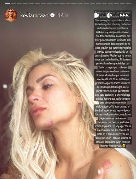 $!En una historia de Instagram publicada durante la madrugada de este lunes 13 de febrero, Cazo mostró las marcas del presunto maltrato. Las más visible son heridas en su mentón y hombro izquierdo.