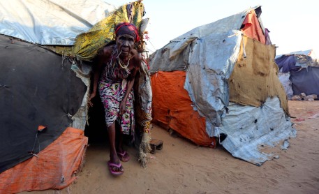 La Hambruna, desnutrición y la falta de agua potable que se vive en Somalia