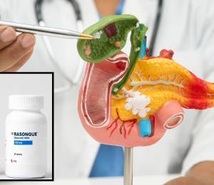 El tratamiento será desarrollado por la start-up estadounidense Revolution Medicines, bajo el nombre comercial Rasonque.