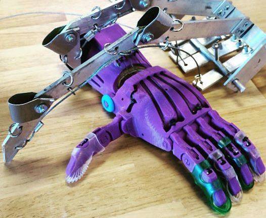 Una prótesis 3D de mano para un niño en Francia