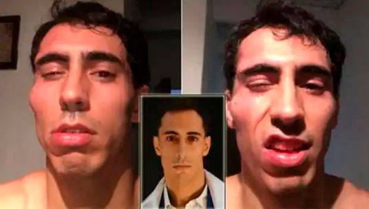 $!Desfiguran la cara a Mister Puerto Rico 2016 en un asalto