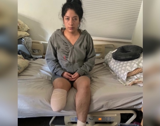 Ecuatoriana perdió su pierna tras ser lanzada de valla en la frontera de Estados Unidos