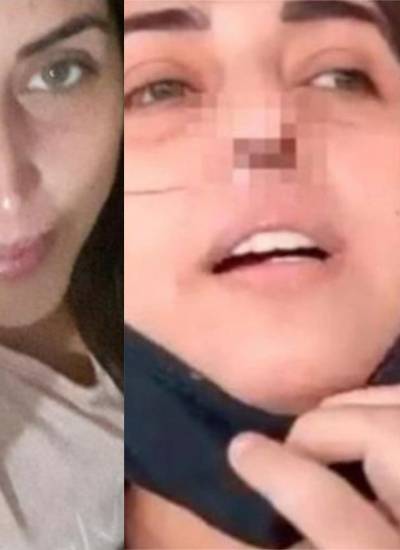 La mujer denunció que un hisopado que se realizó en una clínica privada provocó que se infectara la nariz y la llevó a perder el cartílago.