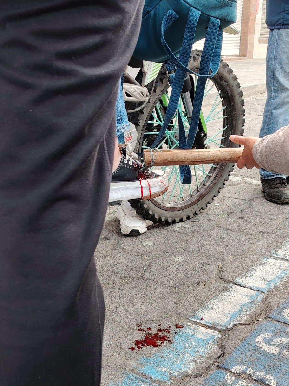 Joven atacada con varilla en su pie 