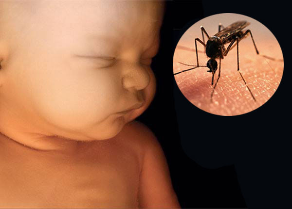 Estudio confirma que virus zika puede transmitirse al bebé por la placenta