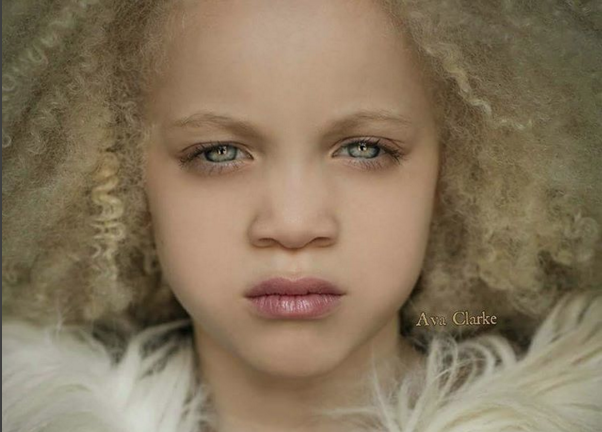 Niña albina de padres afroamericanos revoluciona la moda