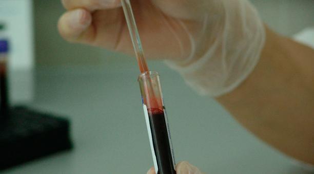 Cuarta parte de personas con VIH en Latinoamérica no lo saben