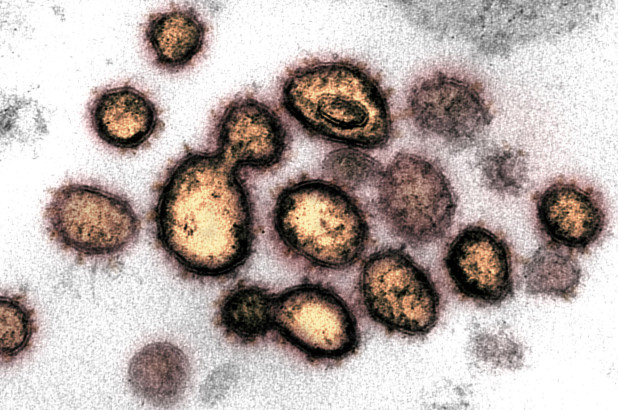 Detectan por primera vez una doble infección de coronavirus en paciente de Islandia