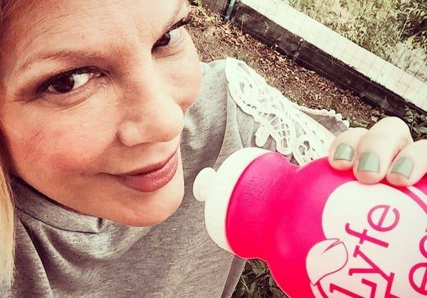 Tori Spelling luce desfigurada tras tratamiento de belleza