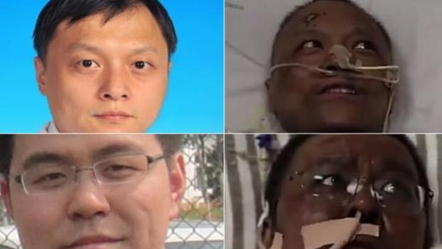 Murió médico chino al que se le oscureció la piel por COVID-19