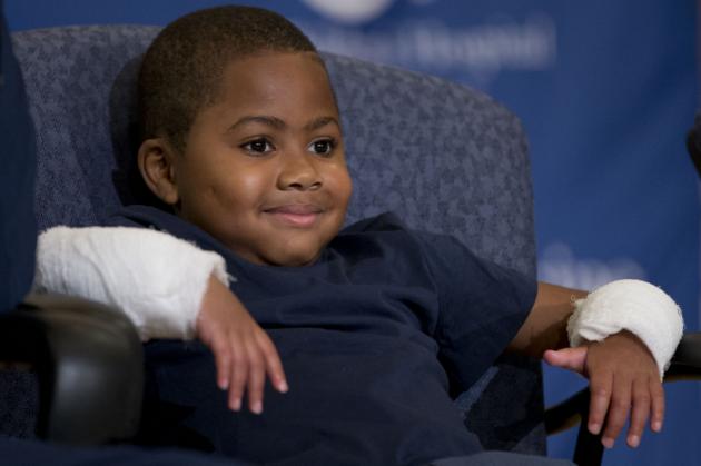 Niño de 8 años recibe trasplante de manos en EE.UU.