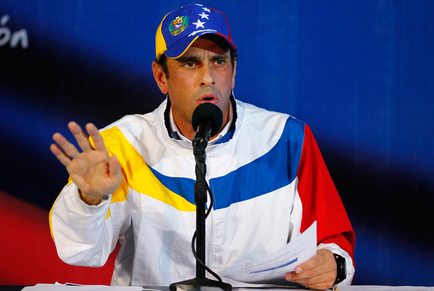 Capriles atendido en EEUU de lesiones en la cara