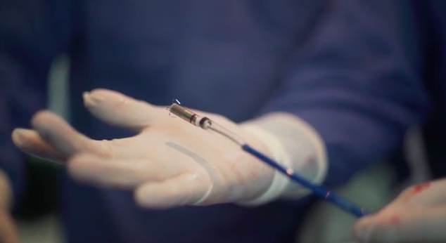 VIDEO: Primer paciente en Ecuador recibe implante de marcapasos inalámbrico y diminuto