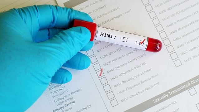 Ecuador registra 39 fallecidos por gripe H1N1.