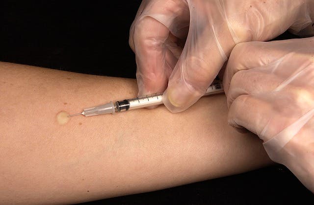 La vacuna contra el sarampión puede evitar muertes por otras enfermedades