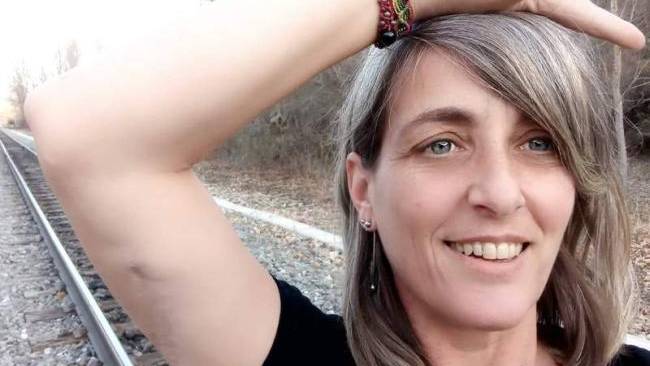 Patricia Casas y su batalla contra una enfermedad olvidada que devora carne: Es como el bocado de un tiburón