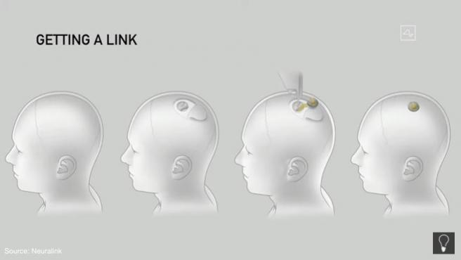 Musk presenta dispositivo para medir actividad cerebral