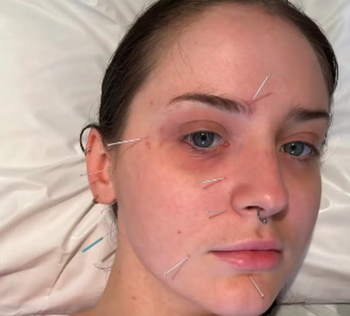 $!La joven ha buscado ayuda de medicina alternativa para curarse.