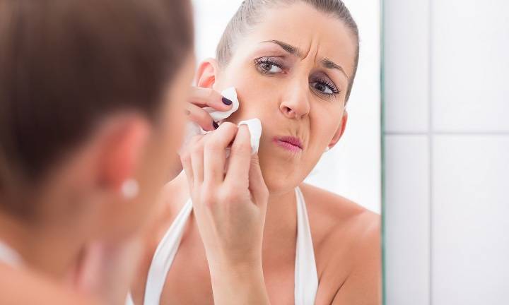 ¿Cuántos grados y lesiones de acné existen?