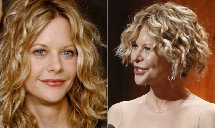 Critican la apariencia de Meg Ryan en los premios Tony