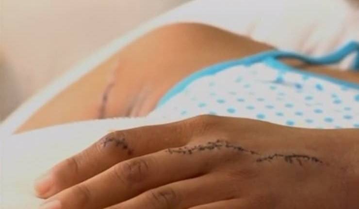 Dos implicadas rinden versión en caso de modelo agredida