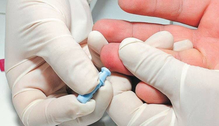 El VIH puede ser erradicado en 15 años, según la OMS