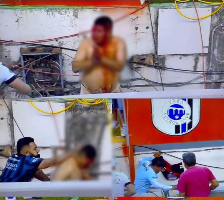 $!Al menos 22 heridos por violencia en partido de fútbol en México