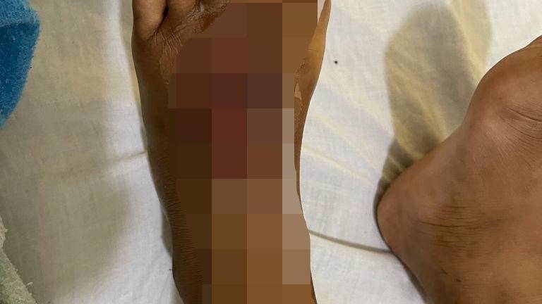 Violaron y torturaron brutalmente a niño de 6 años en Naranjal, pero los principales sospechosos están libres