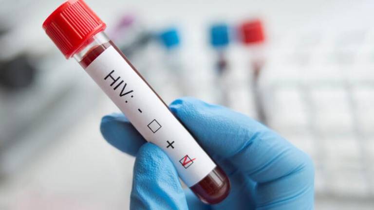 ¿Por qué se lograron en meses las vacunas covid y aún no hay una para el VIH?