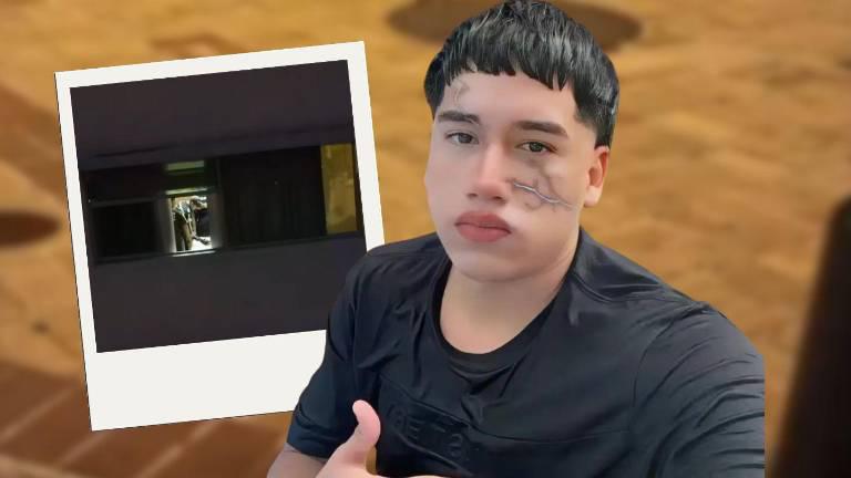 $!Alias 'Frenillo' murió al caer de un edificio.