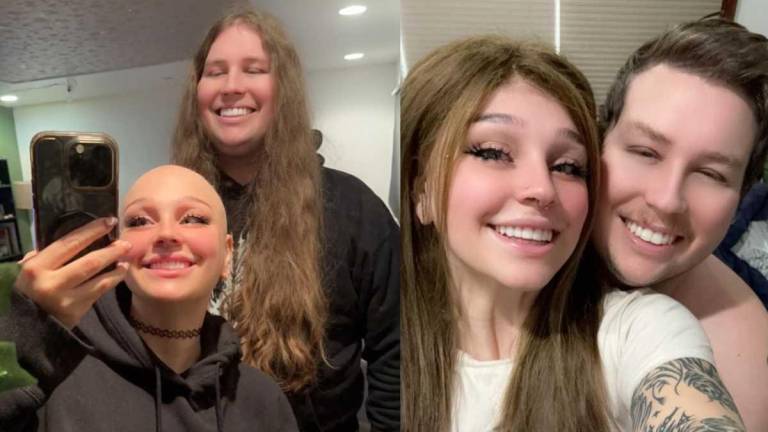 Ella fue diagnosticada con alopecia y su novio se dejó crecer el cabello para hacerle una peluca