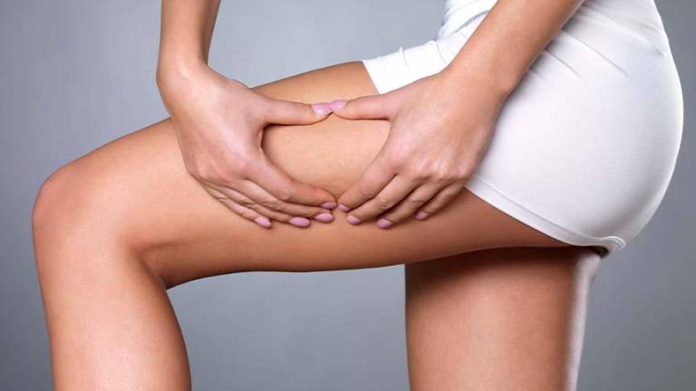 Celulitis, un riesgo para la salud a largo plazo