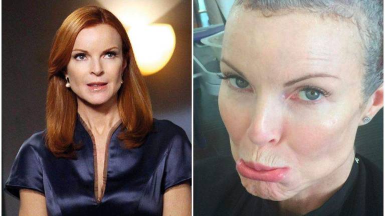 Actriz de “Desperate Housewives” revela que tiene cáncer anal