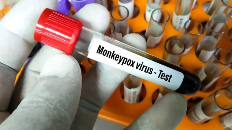 Desarrollan varios tests para detectar la viruela del mono, ante posible incremento de contagios