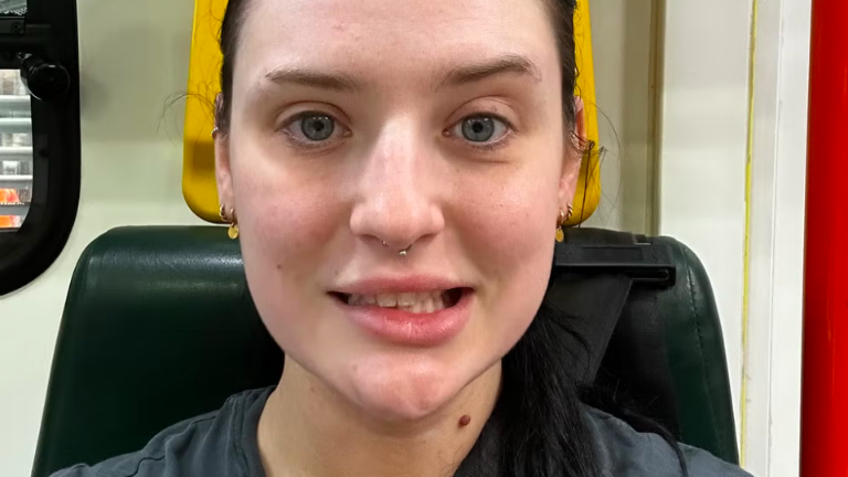 Creyó que tenía gripe, pero era una misteriosa enfermedad que la dejó con la mitad del rostro paralizado