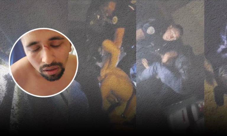 $!Ecuatoriano sufre brutal agresión por parte de la policía francesa, durante su detención