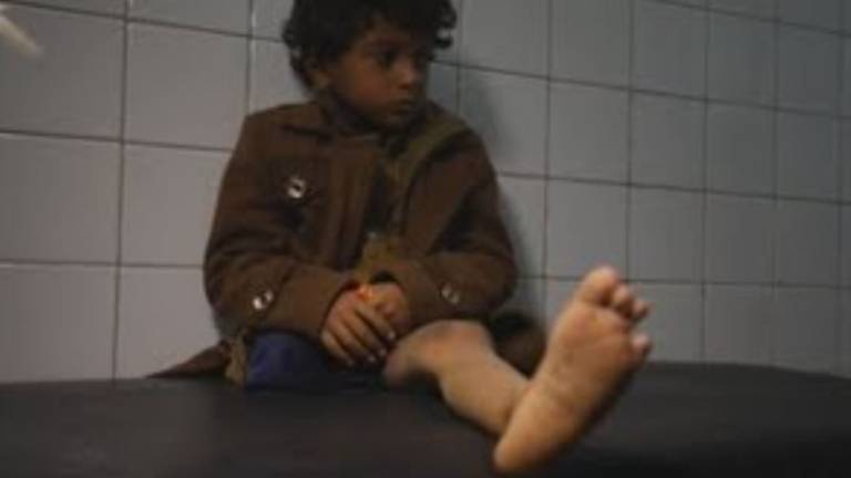 Huérfano y mutilado con 8 años, una de las vidas rotas en la guerra de Yemen; una bomba acabó con parte de su familia
