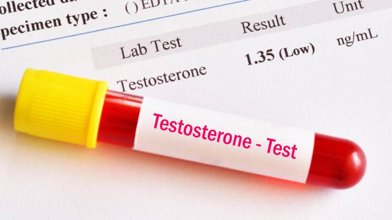 La testosterona es una hormona sexual masculina producida principalmente en los testículos.