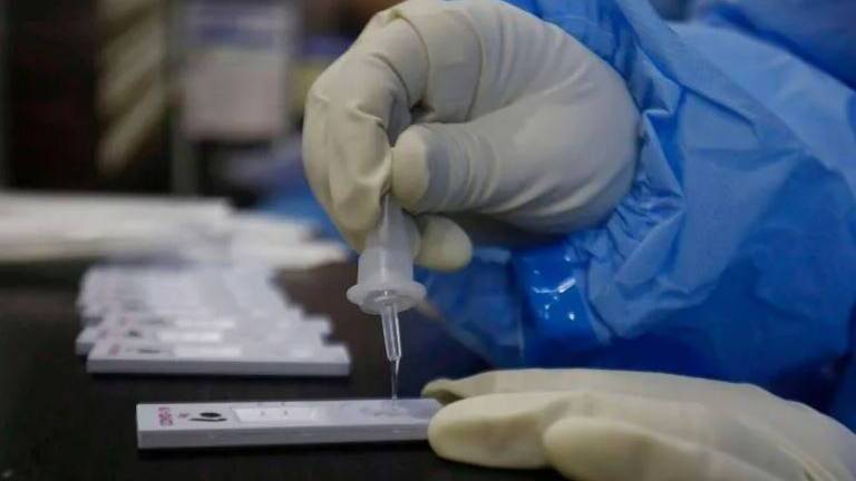 Italia producirá test de saliva que detecta el covid-19 en 3 minutos